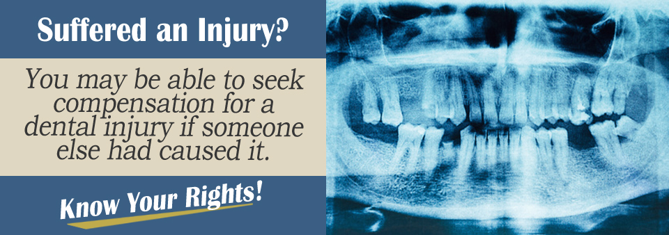 Dental Injuries Personal Injury Lawyer