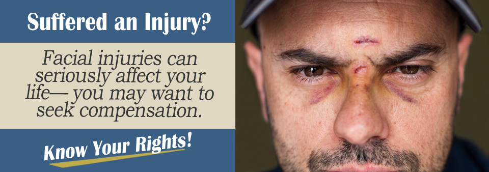 Facial Injury Personal Injury Lawyer