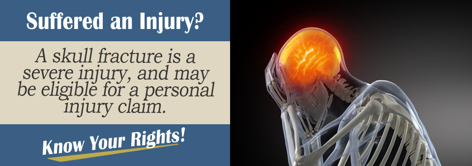 Fractured Skull Personal Injury Lawyer