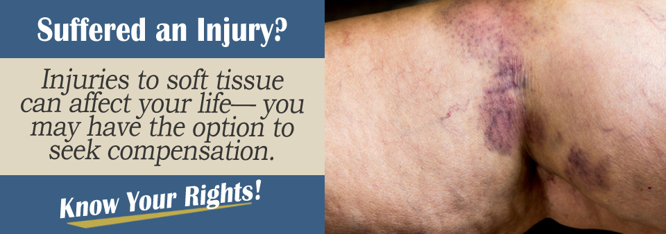 Soft Tissue Injury Personal Injury Lawyer