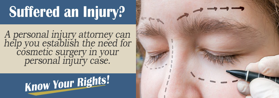 Claiming the Cost of Cosmetic Surgery In a Personal Injury Case
