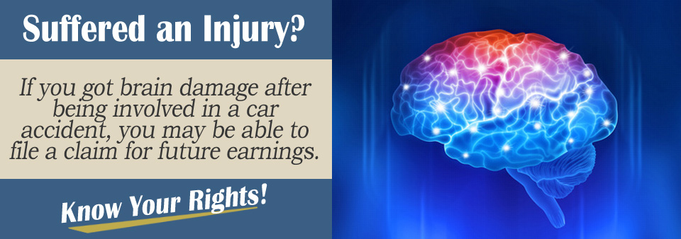I Got Brain Damage in Crash. Can I Claim for Reduced Future Earnings?