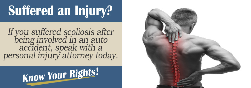 Can Auto Accidents Cause Scoliosis?