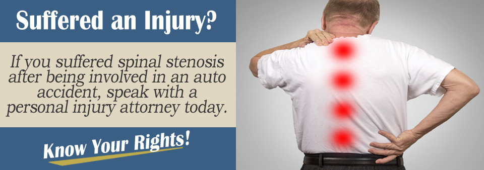 Can Auto Accidents Cause Spinal Stenosis?